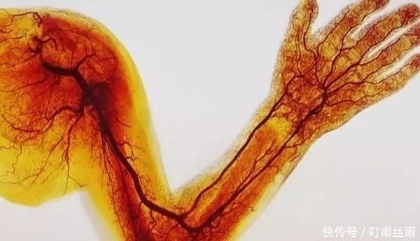 溶解|血管不堵的人，身体会有5个表现，占2个以上，恭喜你血管还不错