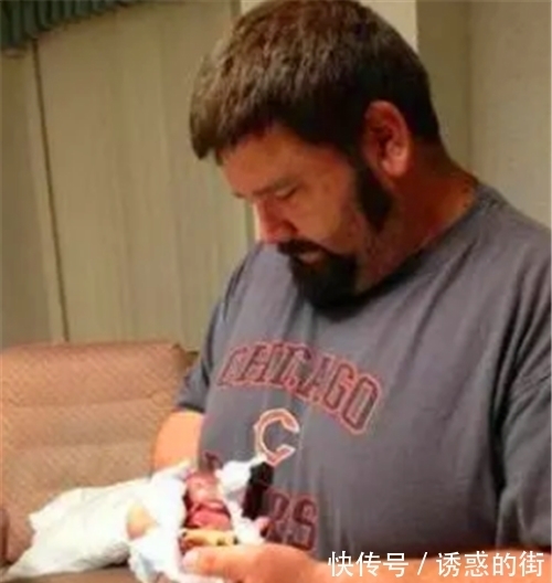 女婴|18年了,那个出生仅280克,曾打破世界纪录的女婴,如今已认不出