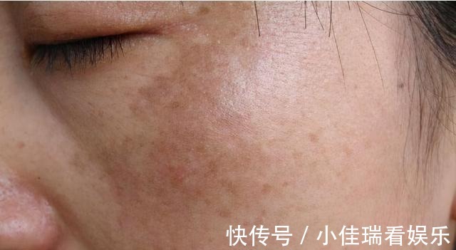 柳女士|女人多喝“牛奶”就能美白？医生坦言：真正有益护肤的，是这3物