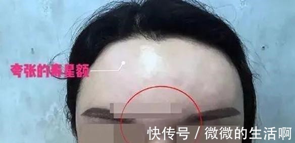 泪沟 别拿宝贵的脸去“试错”,医美项目得这么选(医生经验总结)!