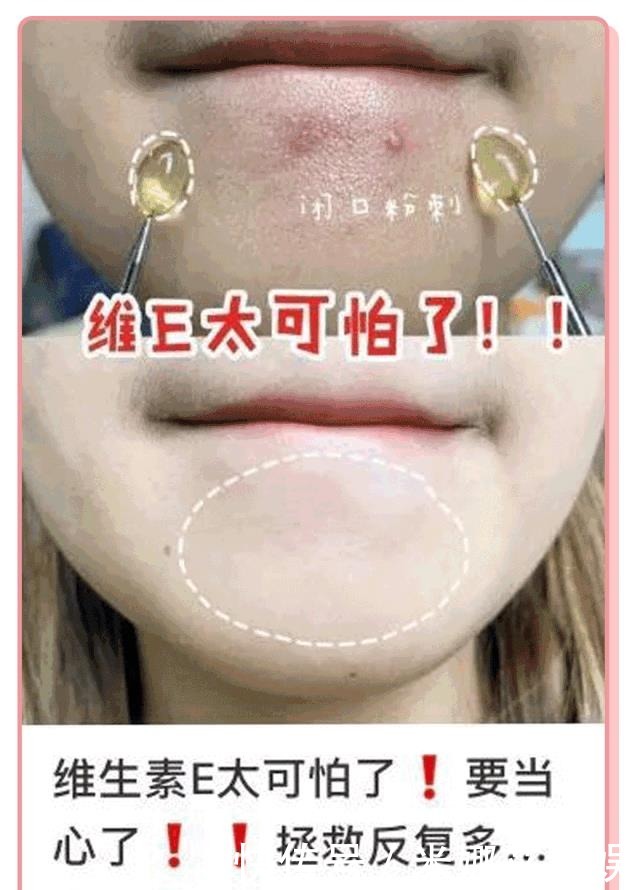 全网|你的护肤方式上黑名单了吗?辟谣10个火爆全网的烂脸护肤伪科学