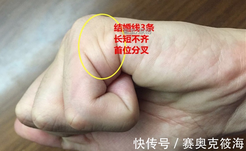 只有右手是川字掌男人