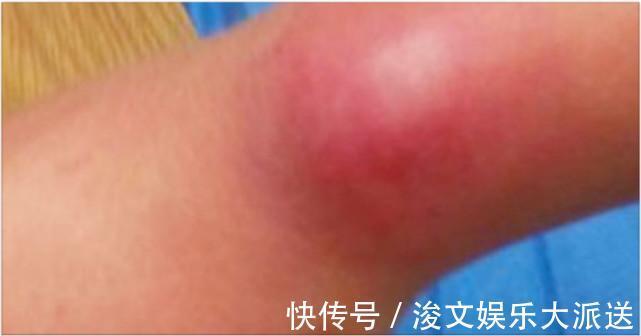 父母|这个隐形杀手每个女孩子可能会戴, 当父母的也需要看看