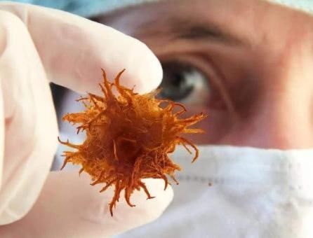 患癌|生活中不易患癌的人,往往都有几个共性,占上一个也不错!