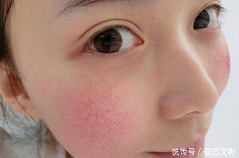 面膜|为何建议女生别“天天敷面膜”,这3个原因你得知道,不敢敷了