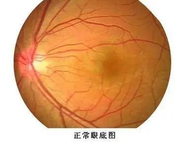 体检最该查什么？这份检查清单一定要看！不花冤枉钱