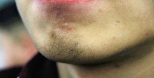 雄性激素|一个男性，如果体内雄激素旺盛，身体会有3个特征，希望你都有