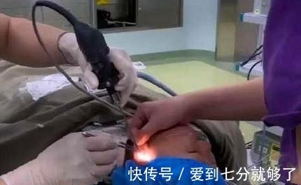 小陈|儿子耳朵不舒服,女子带他去医院检查,没想到耳朵里竟发芽了