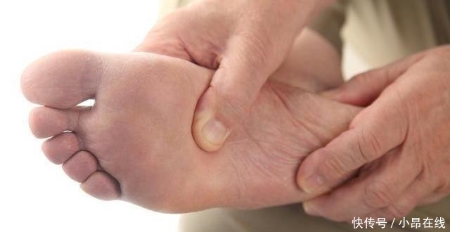 90岁院士研究糖尿病50年,提醒:3种食物或会唤醒糖尿病“因子”