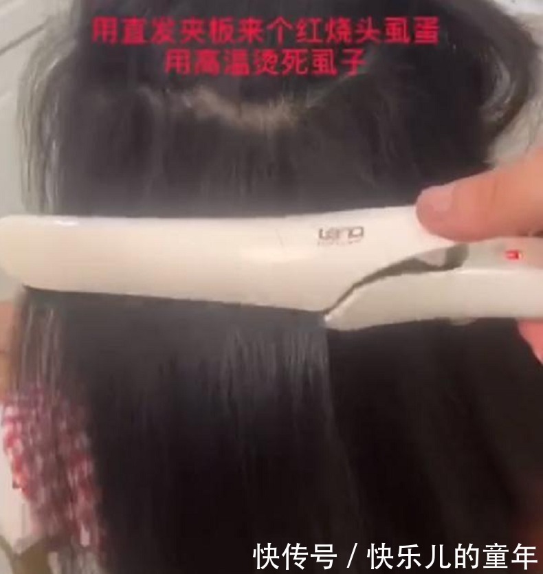 舒适|女儿被同学染上头虱，妈妈用热夹板一夹，下一幕引起舒适