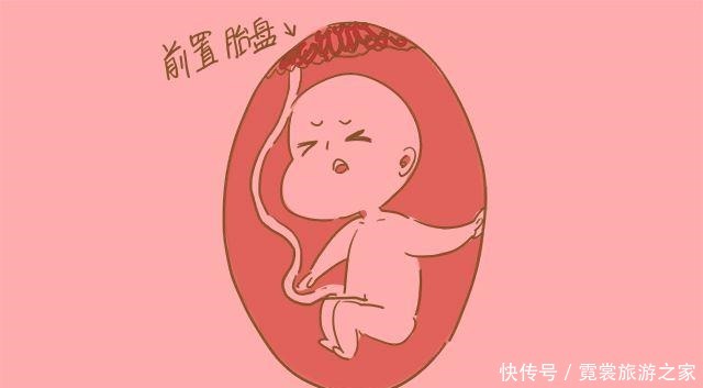 顺产固然好，但遇见这几种情况时只能剖腹产，别傻乎乎不知道