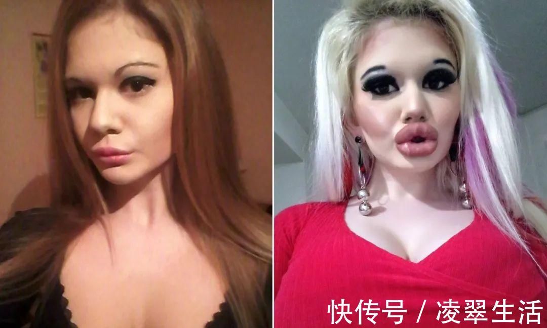 sofia 21次丰唇手术之后，这个妹子的嘴唇现在长这样…