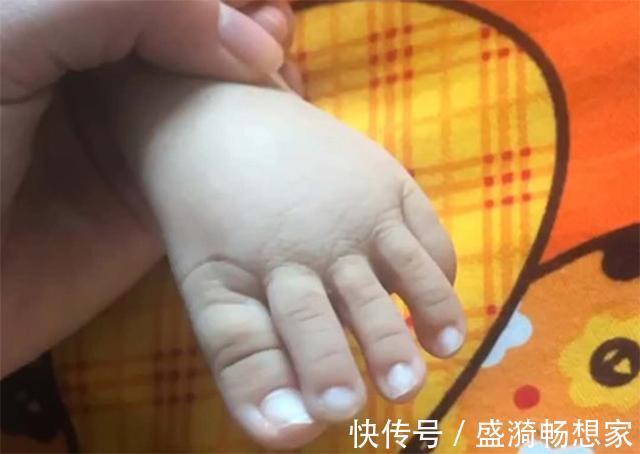 脚型|宝宝出生脚趾比手指还长,妈妈高兴不起来,网友基因突变