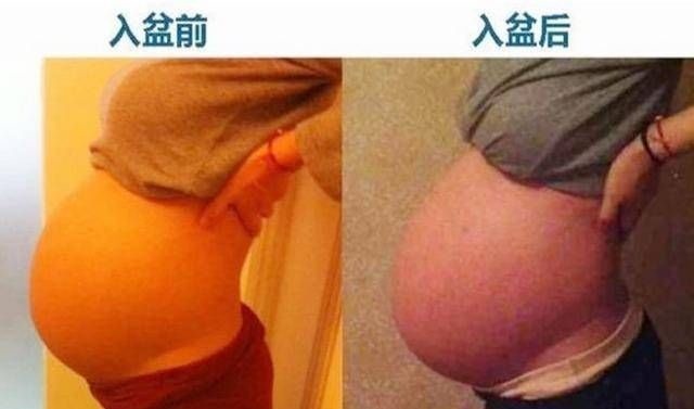 睡眠质量|孕妈出现“五感觉”,肚子出现“三变化”,说明胎儿已经入盆了