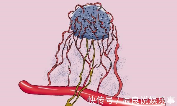 医生|夫妻俩先后查出肺癌，医生：手部早就给出提醒，却没及时发觉