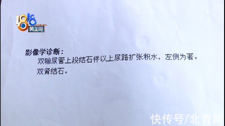 手术支架|术后小便一直出血,手术支架漏取一个