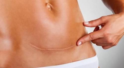 头胎|产检时,医生会问“头胎还是二胎”,这里面的小九九可要知道