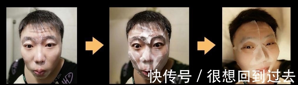 过敏体质|千元一次的“蜗牛爬脸”，真能美容吗？