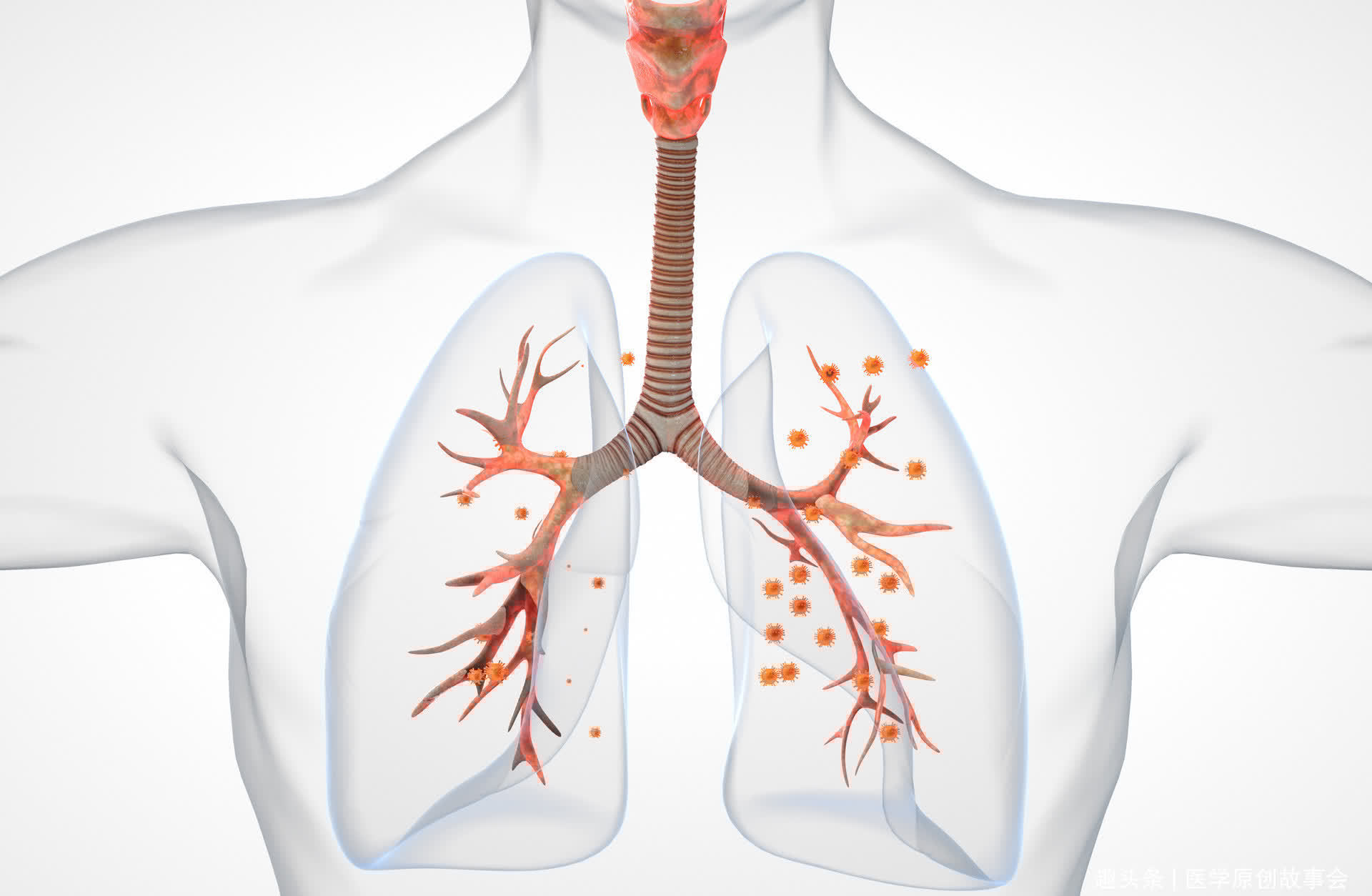 肿瘤主任|晚期肺癌只能活活痛死?肺癌根本不用治?肿瘤主任讲了四个真相