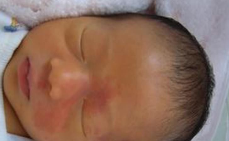 有毒物质|怀孕后，这4件影响宝贝“颜值”的事孕妈最好别做，特别是第一件