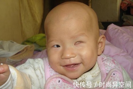 农村|农村孕妇医院产子,医生看到婴儿连连后退,家人无法接受!