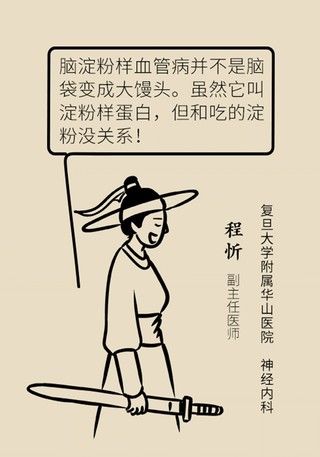 瞌睡|记性变差容易瞌睡，有可能是这种脑出血