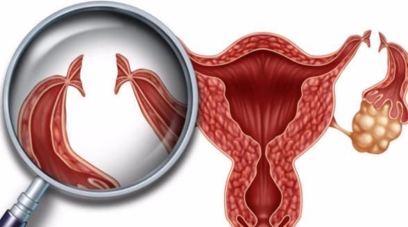 卵巢|据说能帮助女性，抗衰老和延缓绝经期，医生：大多数妇女被骗了！