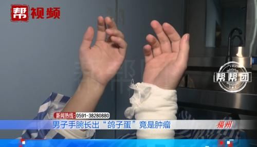 手腕鼓包，一碰就发麻，医生竟从中取出酷似“