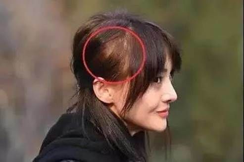 你属于哪种“秃头”类型?找到对应显发量的发型,快来get这些技巧