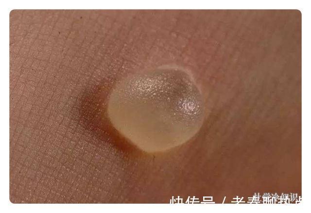 胡萝卜|每日冷知识——大姨妈也有好处!