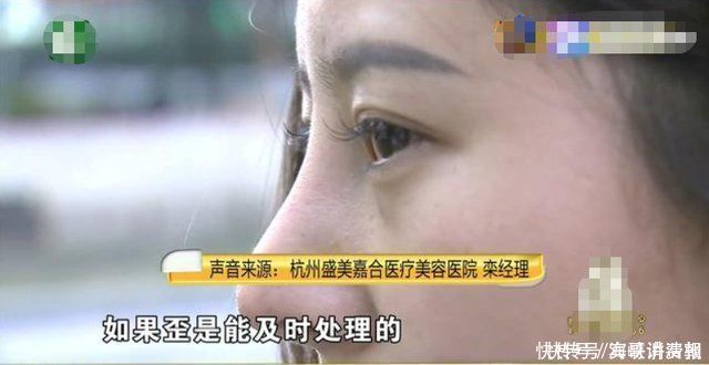 鼻子|爱美女孩去整形,花了3万多整个歪鼻子看起来像“女巫”