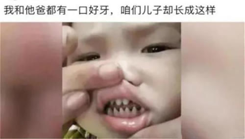 儿子|儿子长了一口“鲨鱼牙”，妈妈连忙送医，医生无知害了孩子