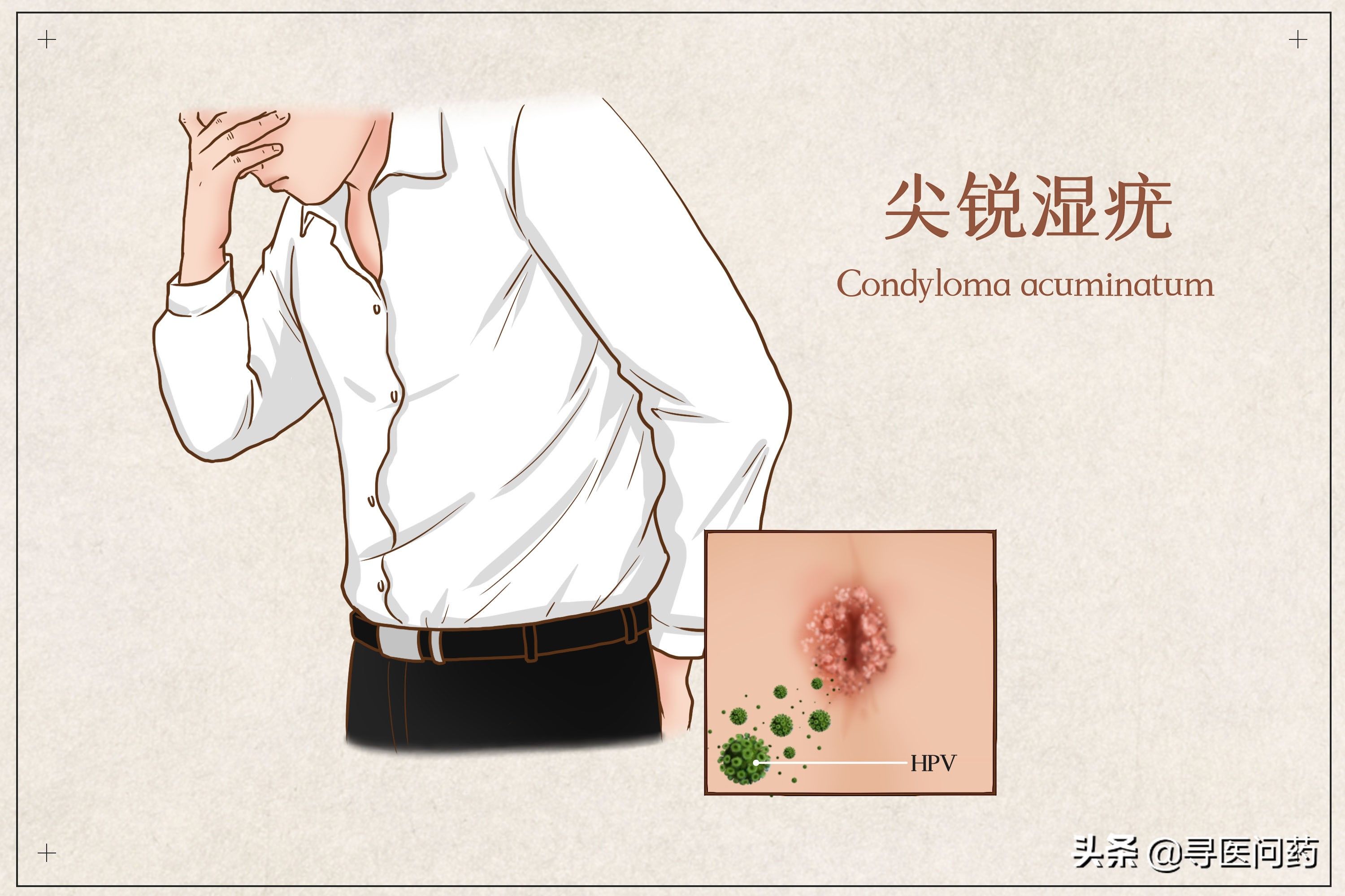 脖子|脖子上的小揪揪别拔，当心是HPV感染，越拔越多