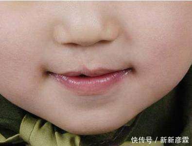 产妇生出“兔唇儿”，谎称孕期吃了兔肉，被医生揭穿后婆婆很恼火