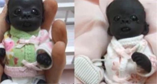 自卑|“世界最黑婴儿”如今5岁了,他变白了吗?网友:不愧是世界之最