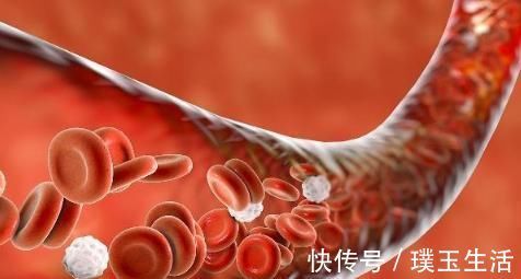 血液|人体能否自动消除”血栓“?做好以下几件事,”血栓“形成不了
