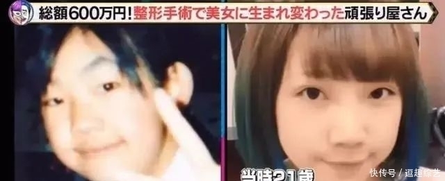 妹子|亲妈鼓励整容，日本妹子十年花600万“变脸”，颜值不输动漫偶像