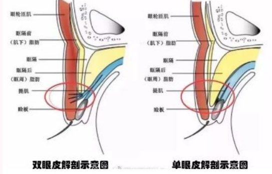 眼轮匝肌|为什么双眼皮修复比做初眼还贵