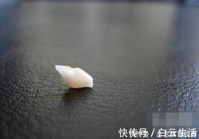 干细胞|孩子乳牙储存起来,能救命?是有条件的,家长别交智商税