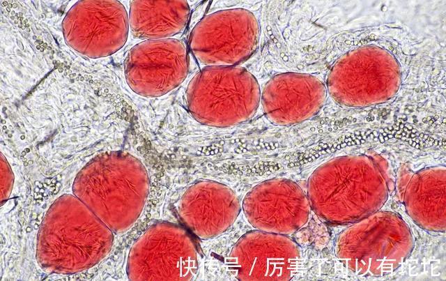 血脂|血管堵塞想疏通，若想血脂健康，謹記：“2戒、3勤、4堅持”