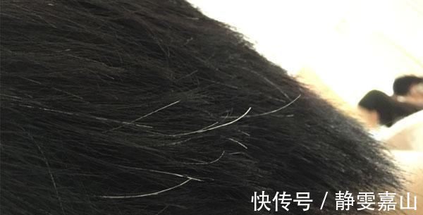 鬓角|身体好不好,看头发就知道,白发的生长位置,暴露了你的身体情况