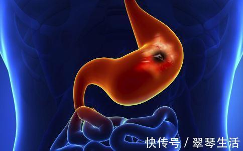 养胃|为什么胃癌偏爱中国人注意这四点,让你远离胃疼胃病