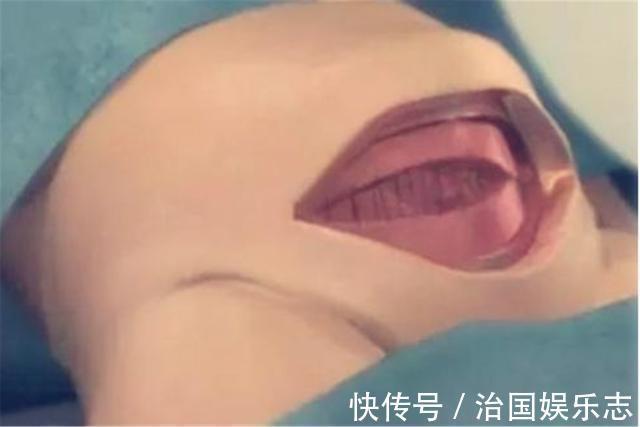 宝妈|九张剖腹产手术全过程图片,那些说生孩子容易的人好好看看