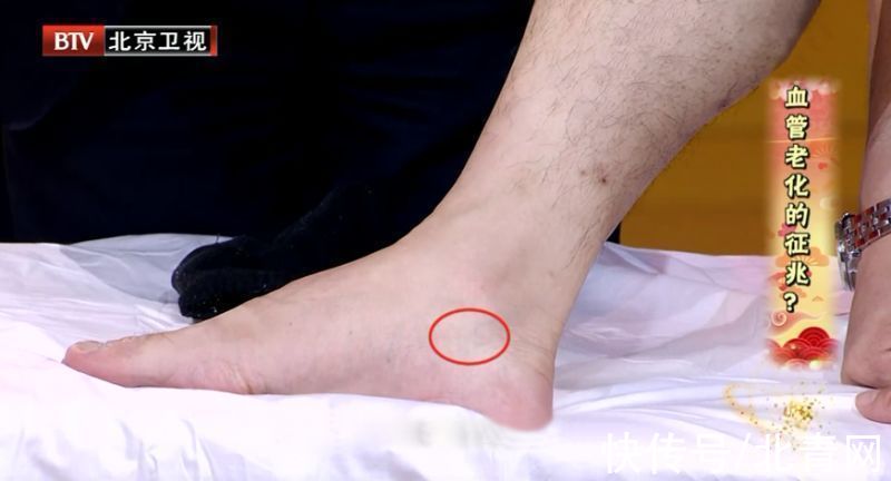 甲亢|各种疾病的早期信号,都在这里了!知道了省钱又救命,赶紧学起来