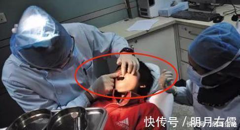 医生|4岁男孩被鱼刺卡喉,奶奶“两招”救了孙子,医生:姜还是老的辣