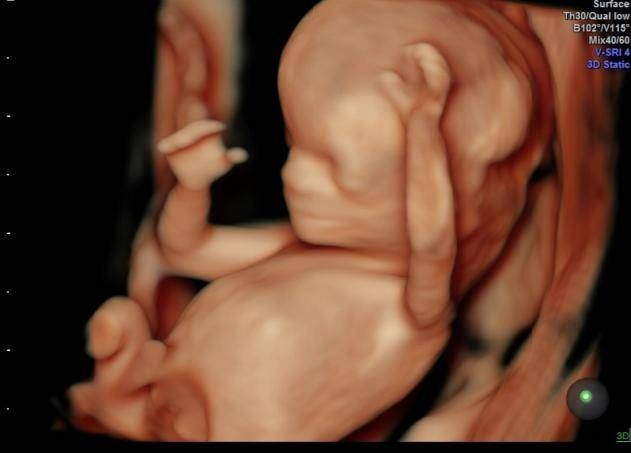 医生|为什么有些医院做四维彩超不让家属陪同这些原因,大家有权知道