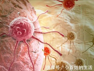 癌症|癌细胞“最怕”的13种食物,不仅有助于预防癌症,还能延长寿命