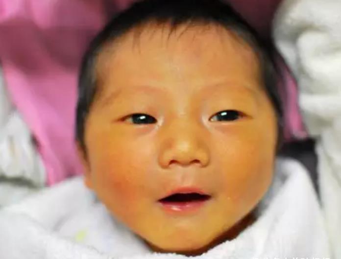 病理性|一月黄疸二月肠绞痛,新生儿月月生病?父母别慌这份发育指南收好