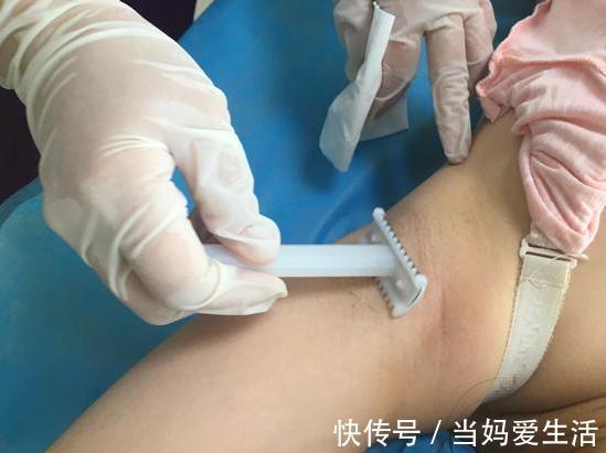 90后|90后孕妈坚持剖腹产,只为不“备皮”,医生尴尬:一样躲不过