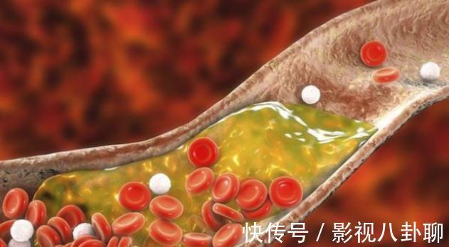 陈大爷|年龄越大，就越要多吃肉？医生：过60岁以后，这2种肉不妨多吃些